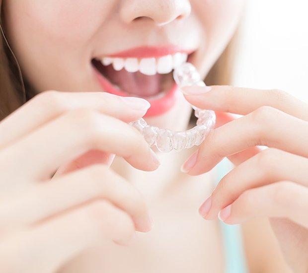 San Diego Alternative to Braces for Teens