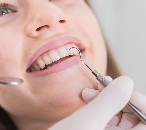 San Diego Dental Cleaning